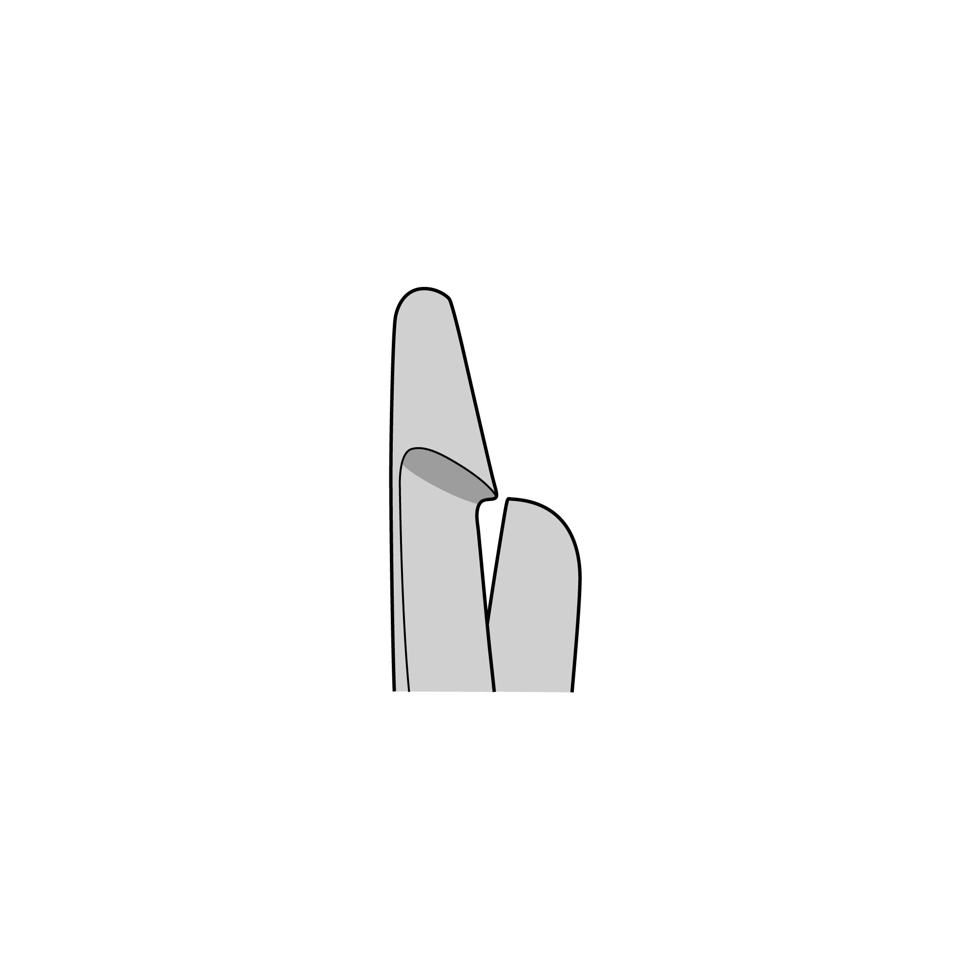 Standard Surgical Scissors with Stop | 14200-21
